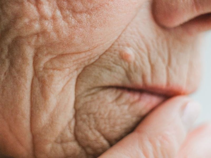 Close-up of a person's hands resting in a calm, meditative gesture.